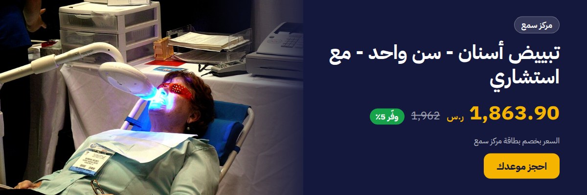 تبييض أسنان - سن واحد - مع استشاري